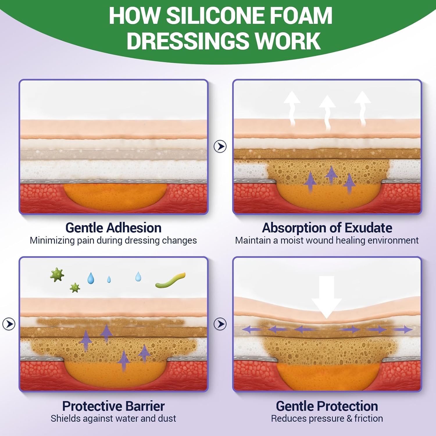 Silicone Foam Dressing – High Absorbency Wound Bandage with Border, 2" x 2", Schneider VitaFoam - SchneiderDirect.com