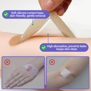 Silicone Foam Dressing – High Absorbency Wound Bandage with Border, 2" x 2", Schneider VitaFoam - SchneiderDirect.com