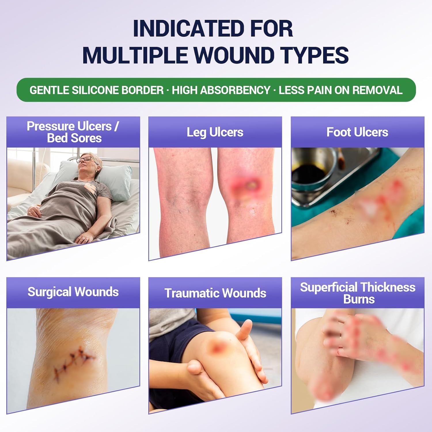 Silicone Foam Dressing – High Absorbency Wound Bandage with Border, 2" x 2", Schneider VitaFoam - SchneiderDirect.com